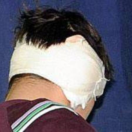 ЕПИЛОГ ТУЧЕ У ЦЕНТРУ АПАТИНА: ТЕШКЕ ТЕЛЕСНЕ ПОВРЕДЕ И ОДГРИЖЕН ДЕО УВЕТА